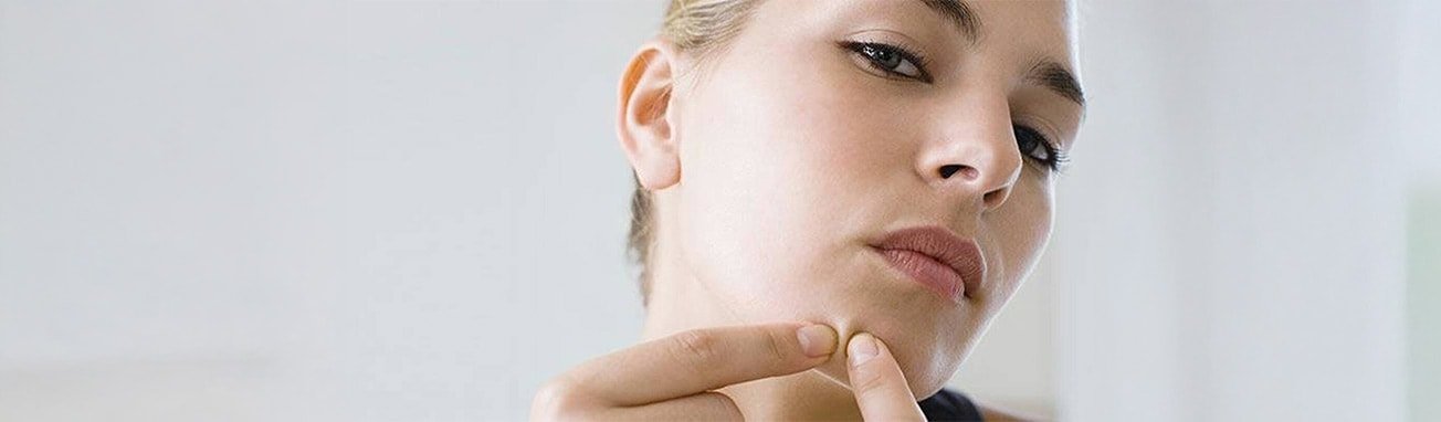 Artikel over acne - hoofdpagina