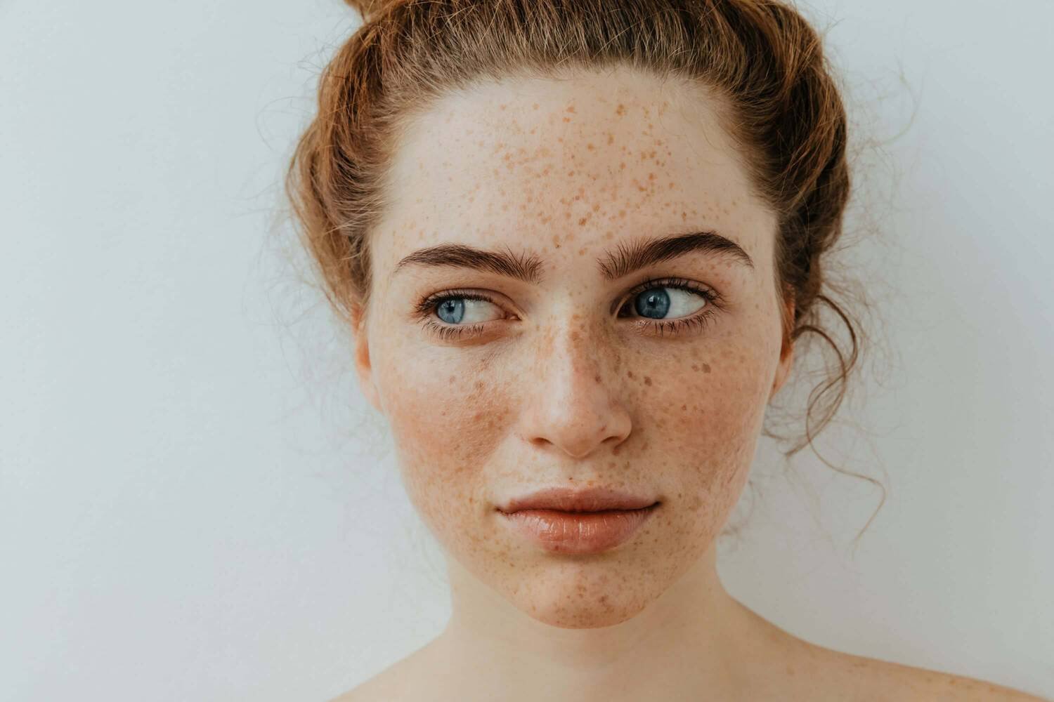 pigmentation-peau_11