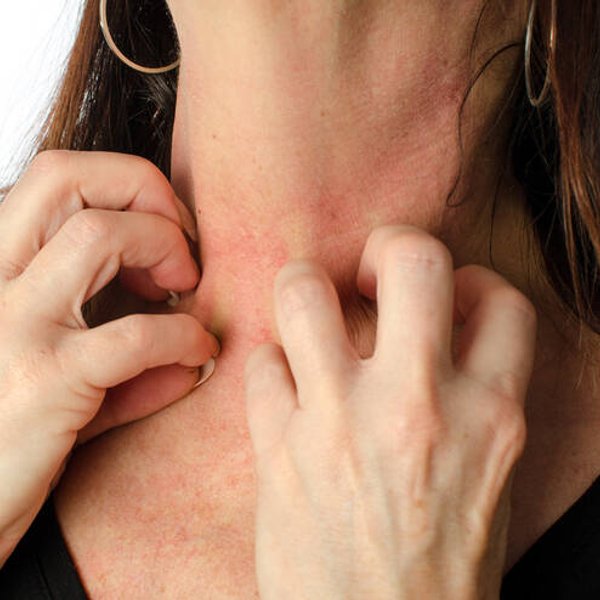 L eczema atopique causes et traitement Header banner