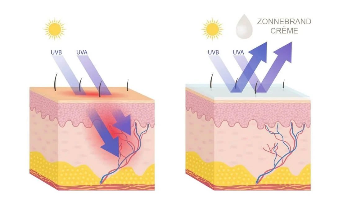 de ingrediënten van sunblock een barrière creëren die de zonnestralen fysiek blokkeren en afbuigen